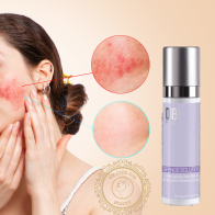 DIBI DEFENCE SOLUTION - Успокояващ крем против зачервяване - 50мл